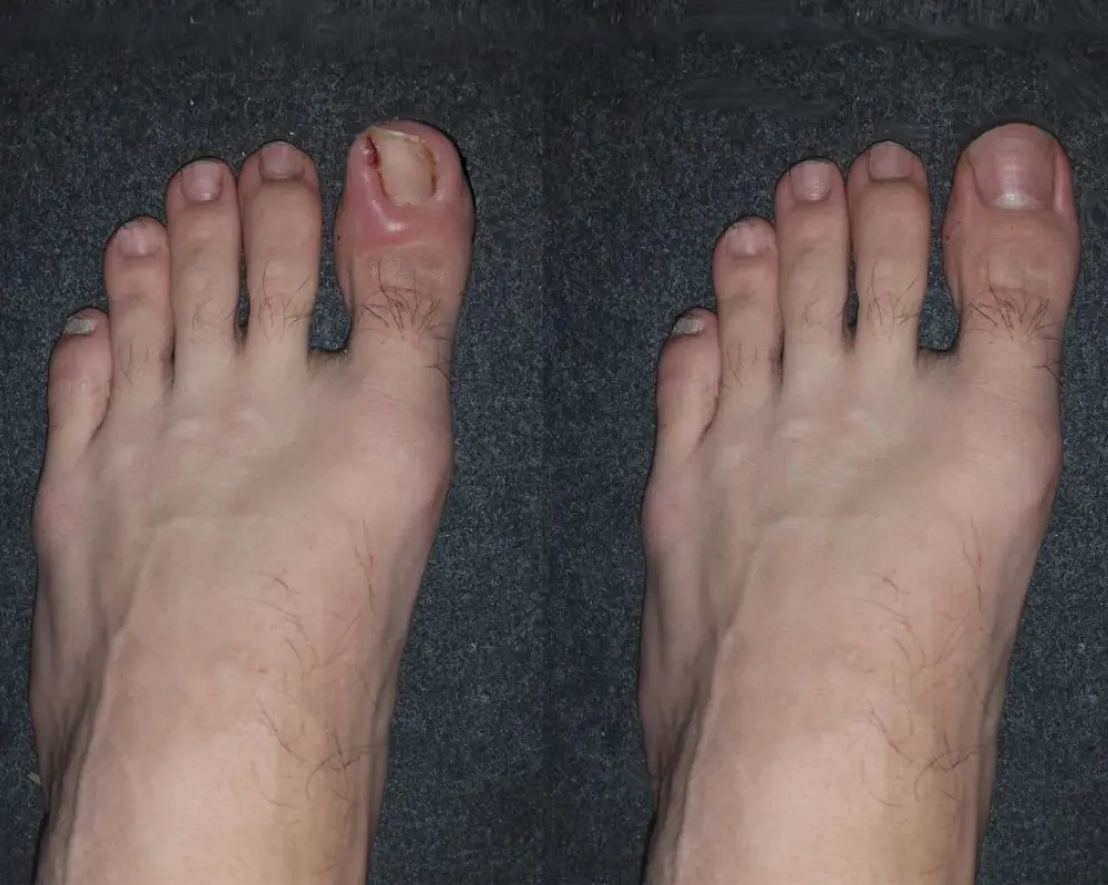 Before treatment
